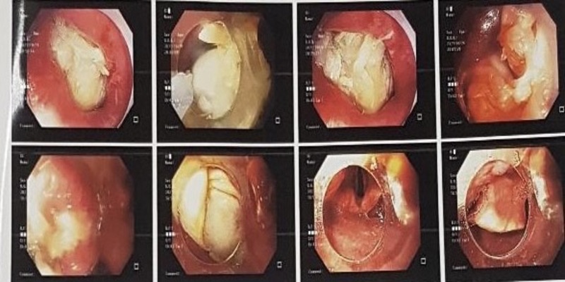 Cách nuôi gà đá không bị hốc là tránh chiến kê bị mắc đờm trong cổ họng